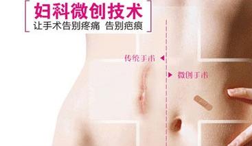 腹腔镜，告别子宫肌瘤治疗一刀切