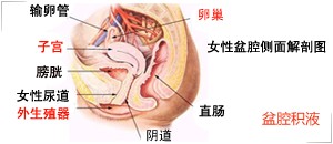 不要让盆腔积液夺走“孕“气