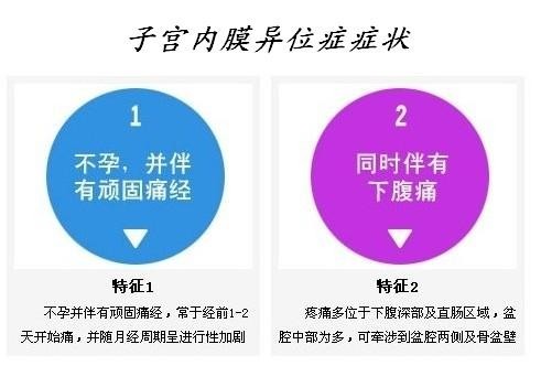 诱发子宫内膜异位症的原因有哪些？